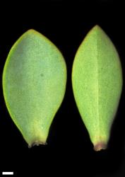 Veronica pinguifolia. Leaf surfaces, adaxial (left) and abaxial (right). Scale = 1 mm.
 Image: W.M. Malcolm © Te Papa CC-BY-NC 3.0 NZ